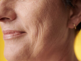 Przybliżenie na zmarszczki na policzkach